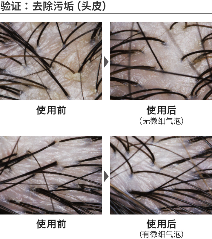 验证：去除污垢（头皮）